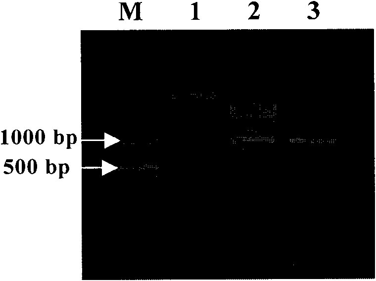 Antibody against lactate dehydrogenase of plasmodium vivax, related preparation method, hybridoma cell strain and application