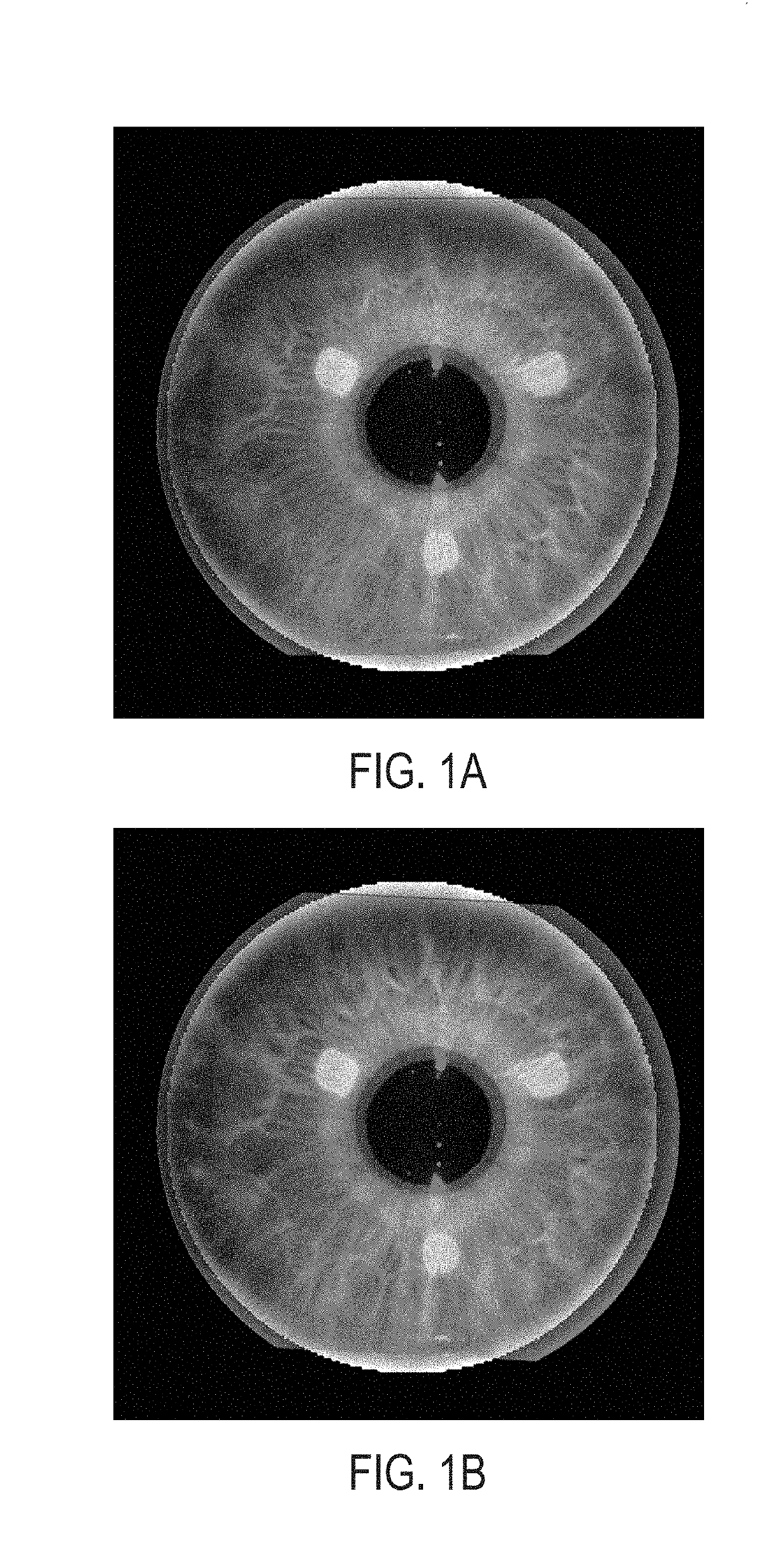 Overlay imaging for registration of a patient eye for laser surgery