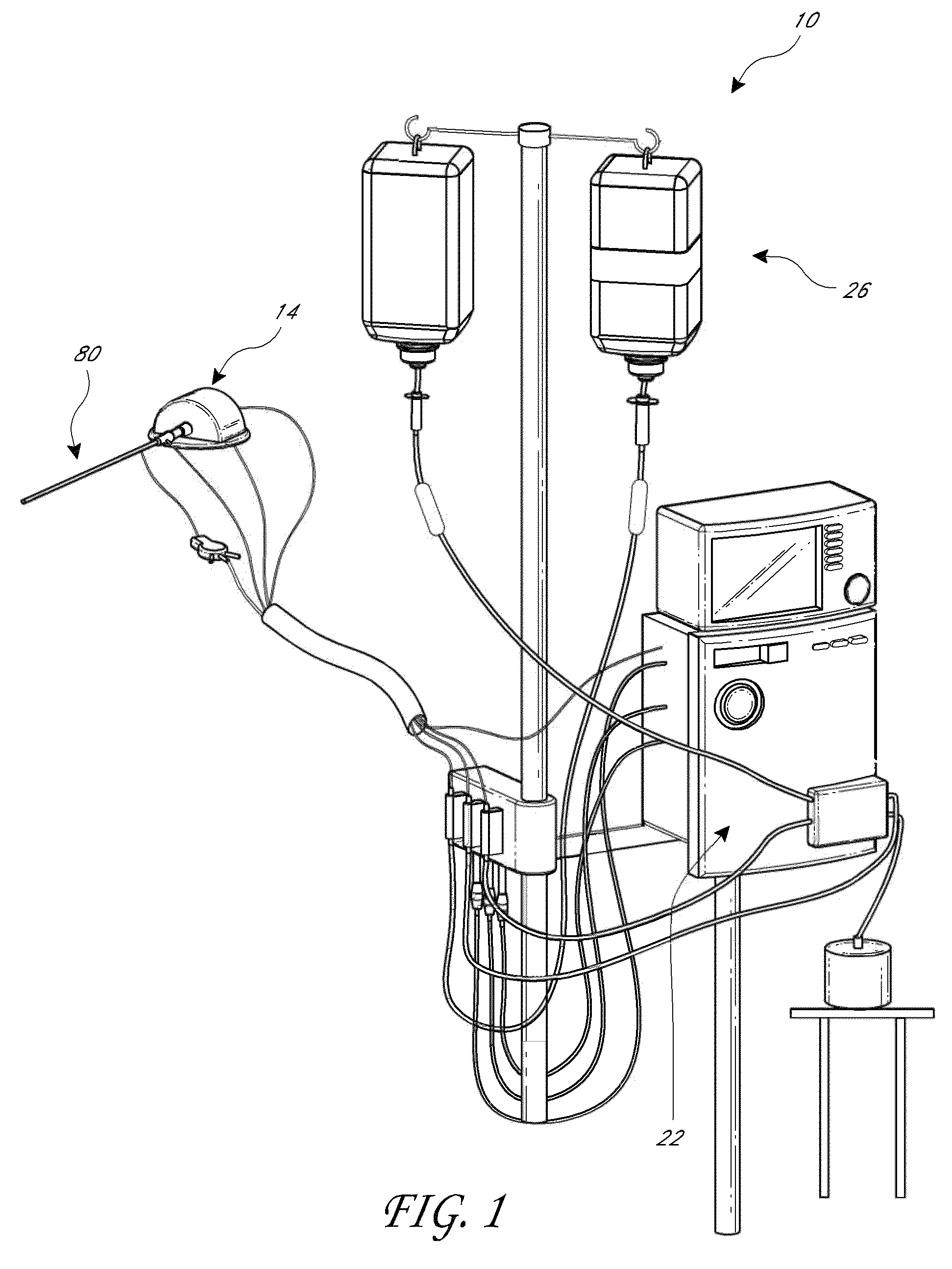 Catheter pump assembly including a stator