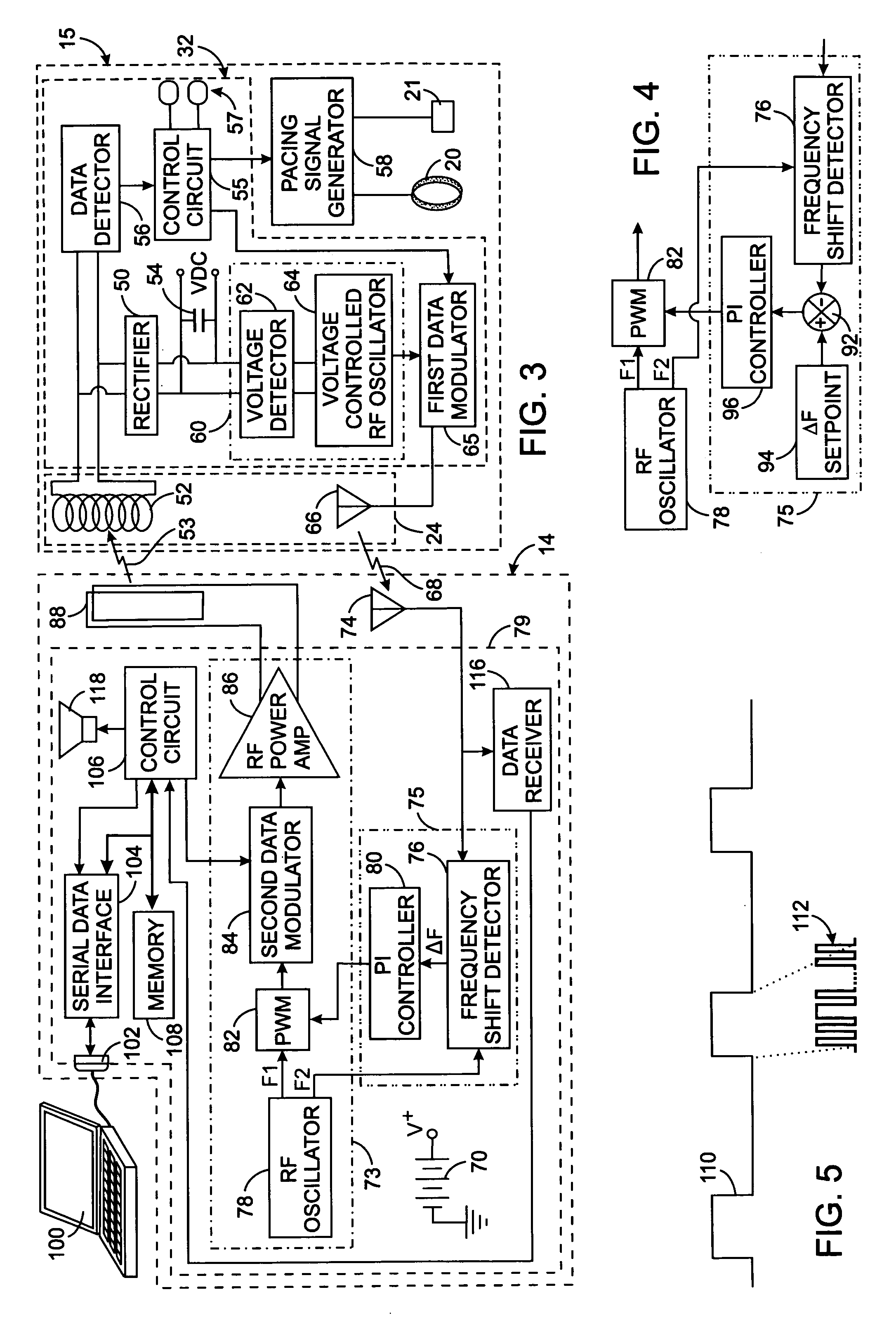 Extracorporeal power supply with a wireless feedback system for an implanted medical device