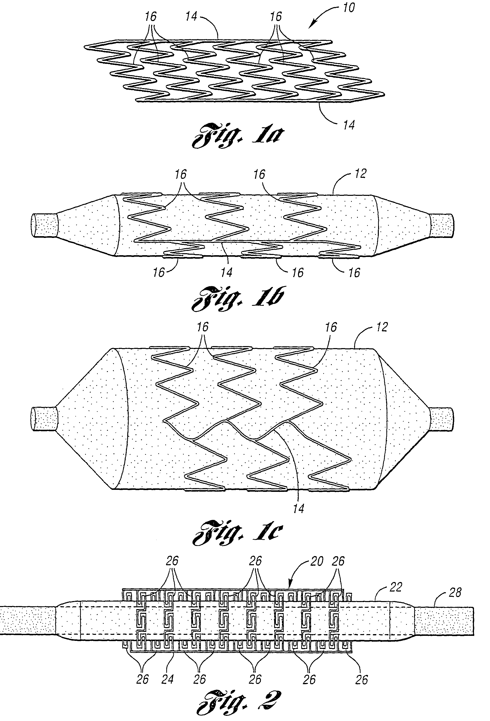 Assembly and planar structure for use therein which is expandable into a 3-D structure such as a stent and device for making the planar structure