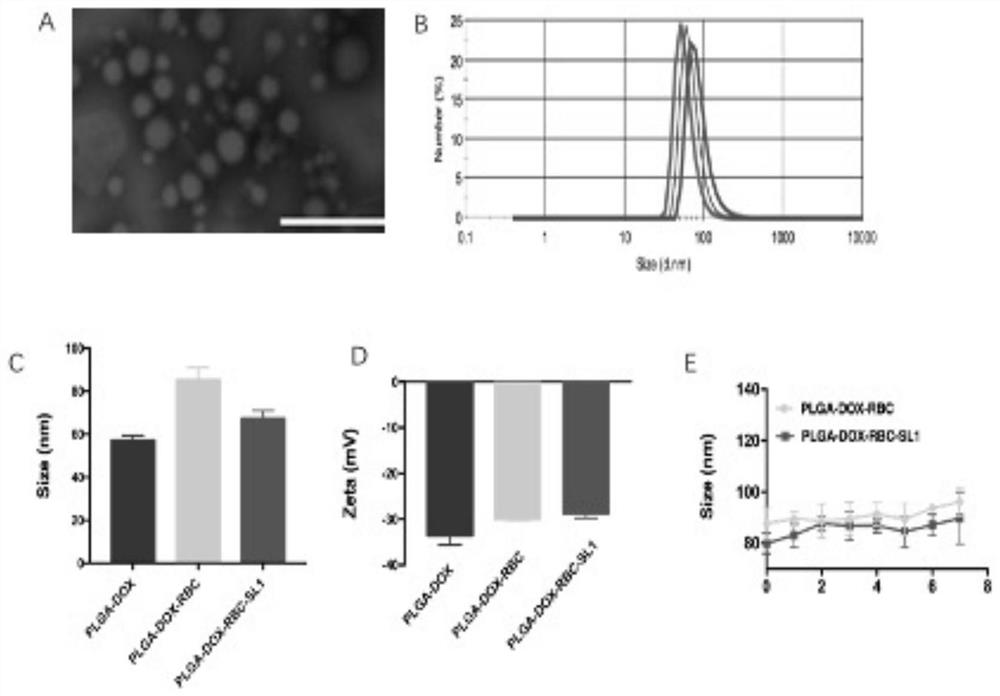 Erythrocyte membrane coated drug-loaded nanoparticles/probes and application thereof in diagnosis and treatment of glioblastoma multiforme