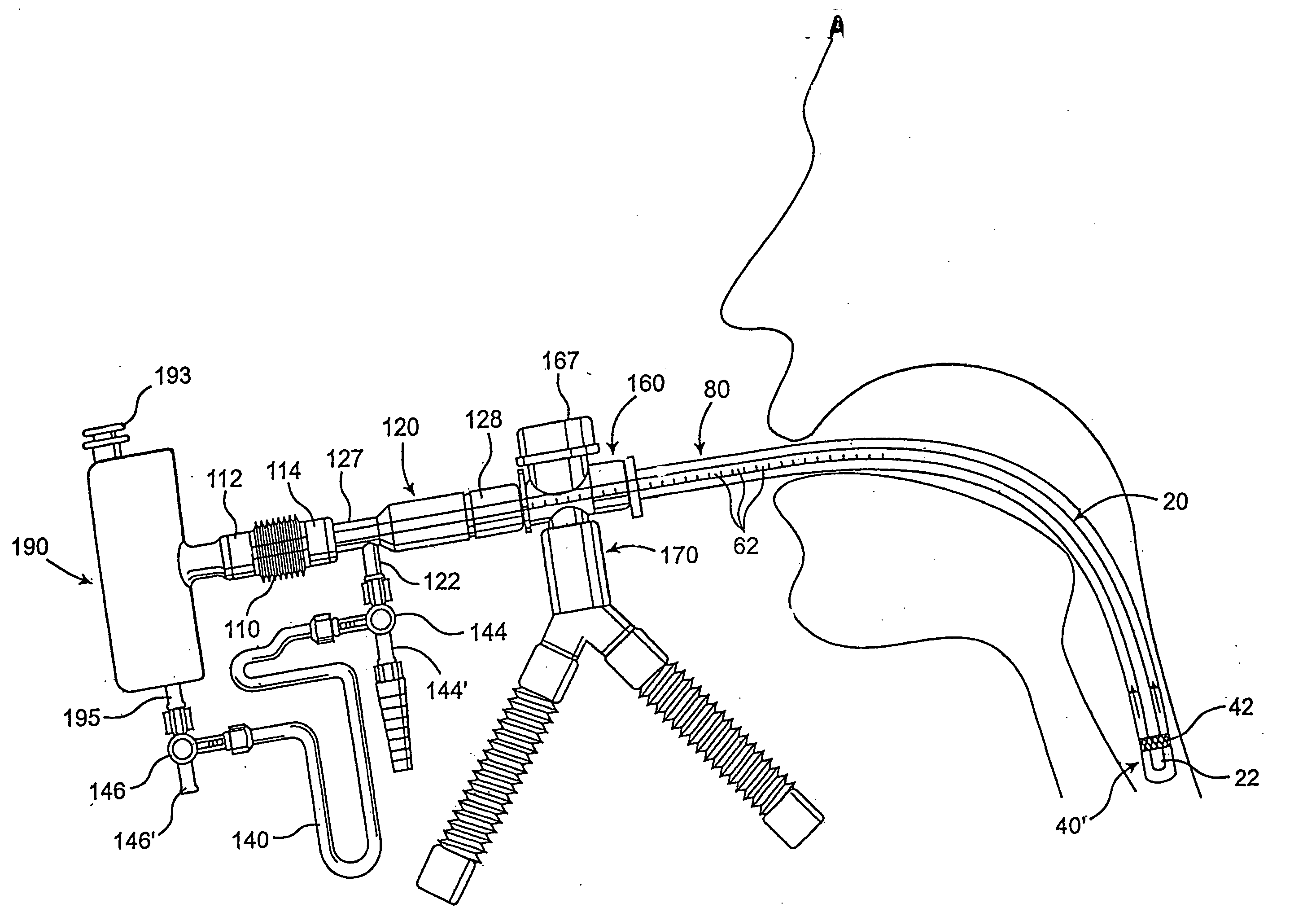 Endotracheal tube cleaning apparatus