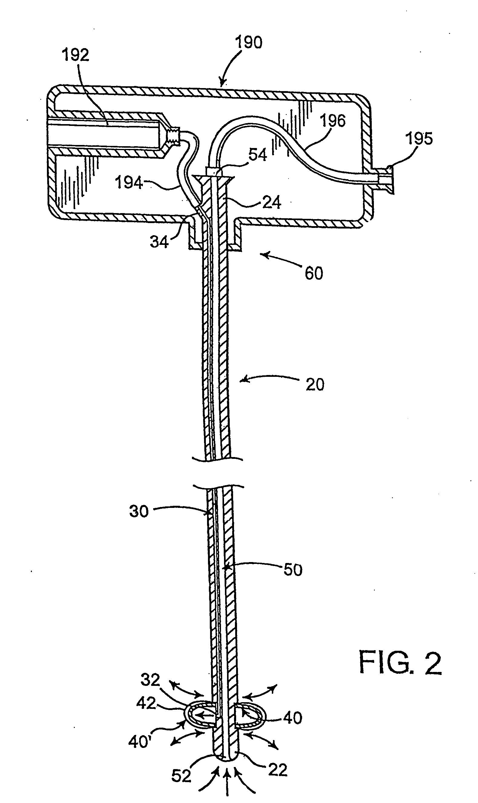 Endotracheal tube cleaning apparatus