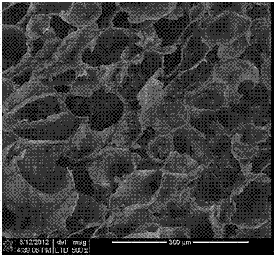 Nano-hydroxyapatite/chitosan/chondroitin sulfuric acid composite stent