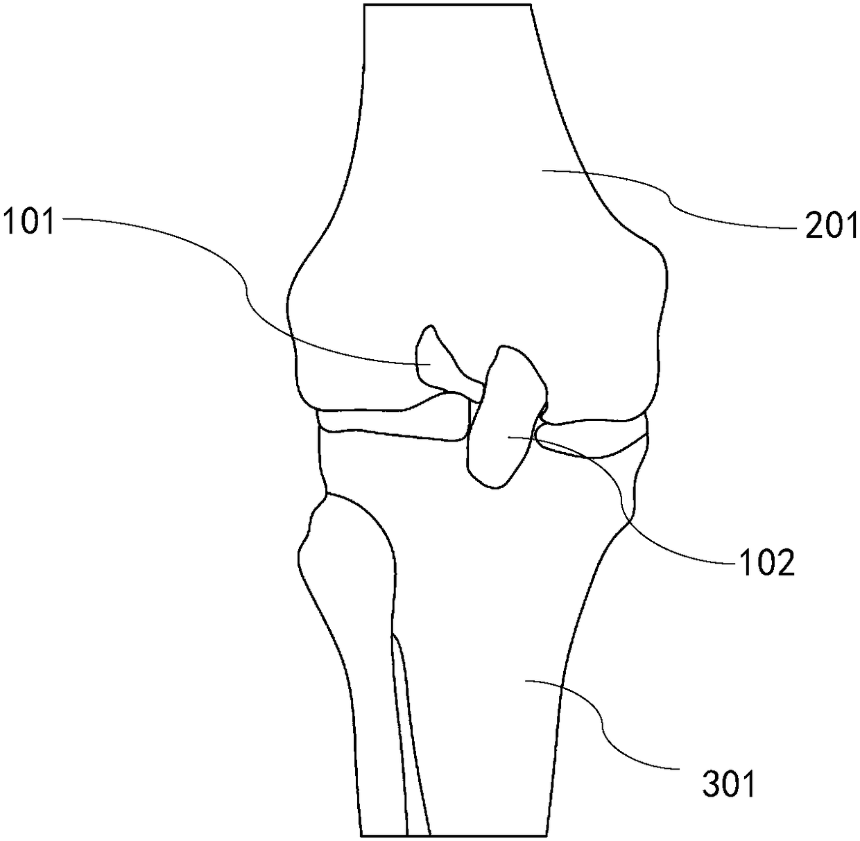 Human body model for knee joint replacement simulation operation