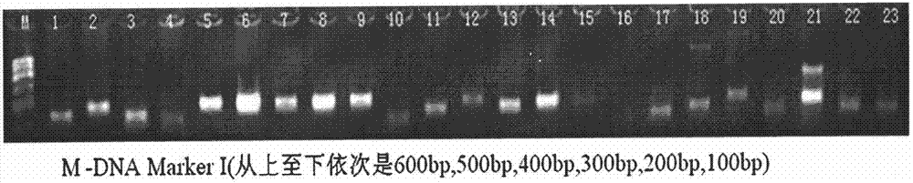 Diabetic retinopathy related gene polymorphism detection kit, and preparation method and purpose thereof