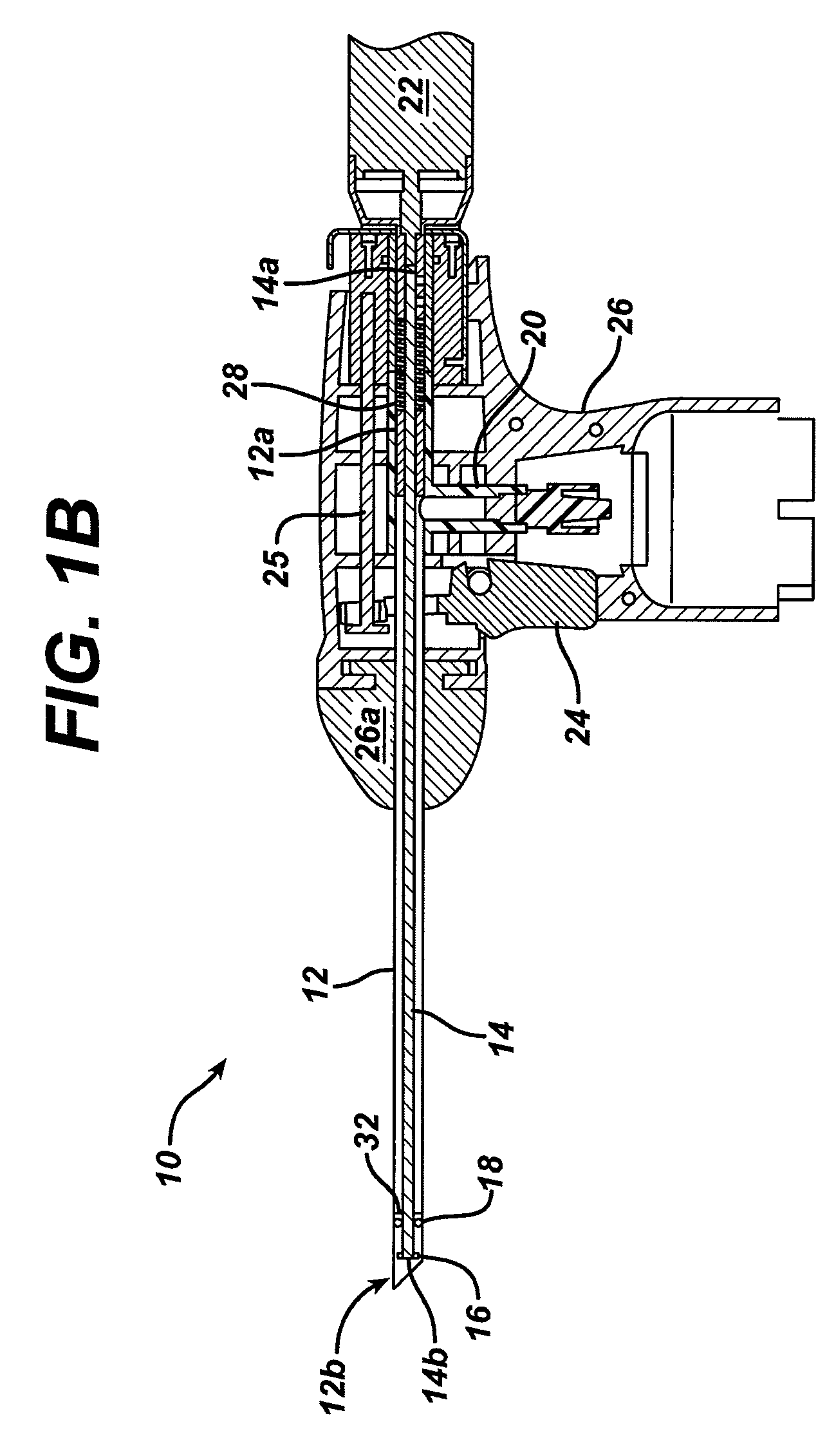 Tissue extraction and maceration device