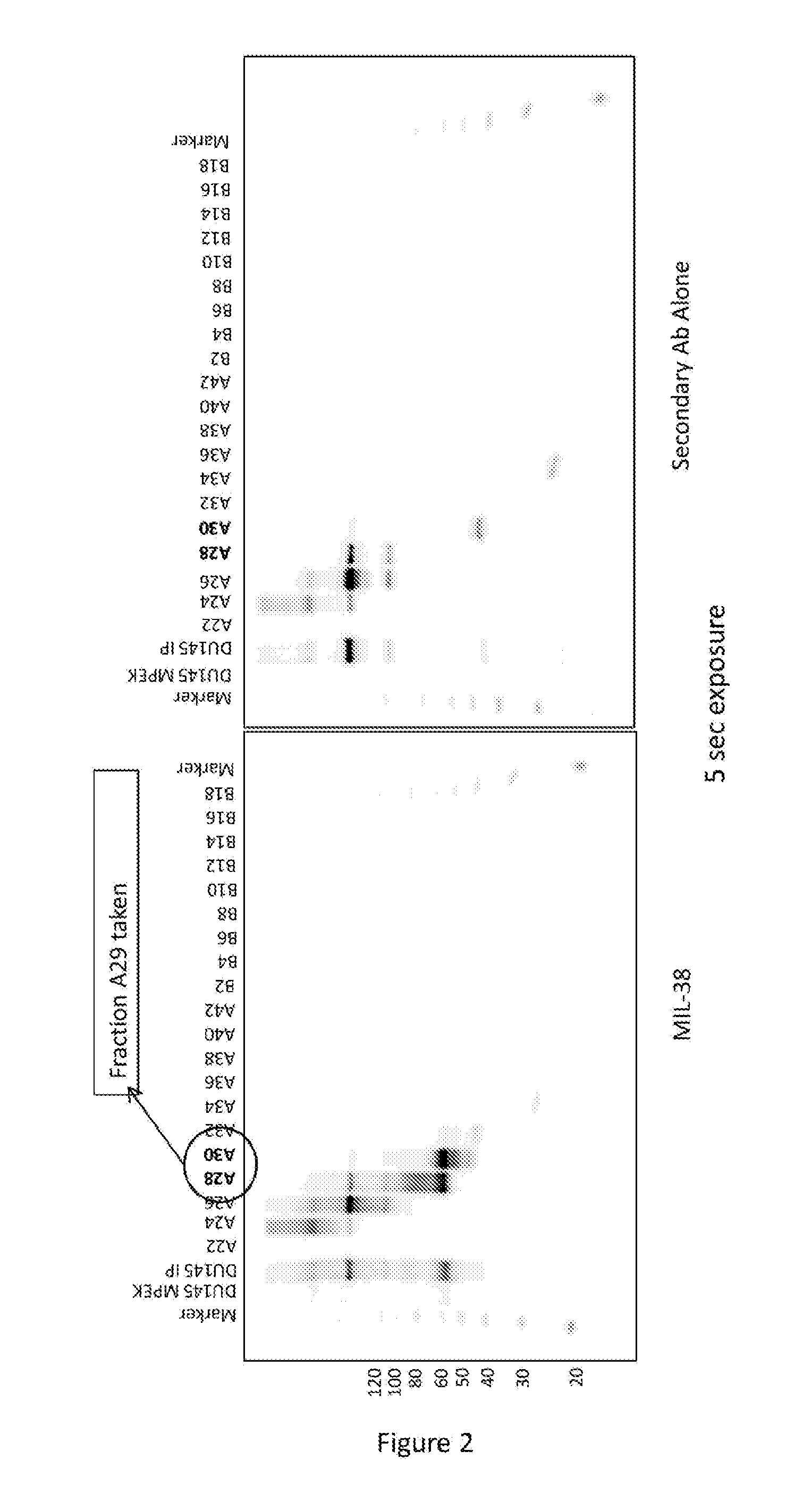 Cell surface prostate cancer antigen for diagnosis