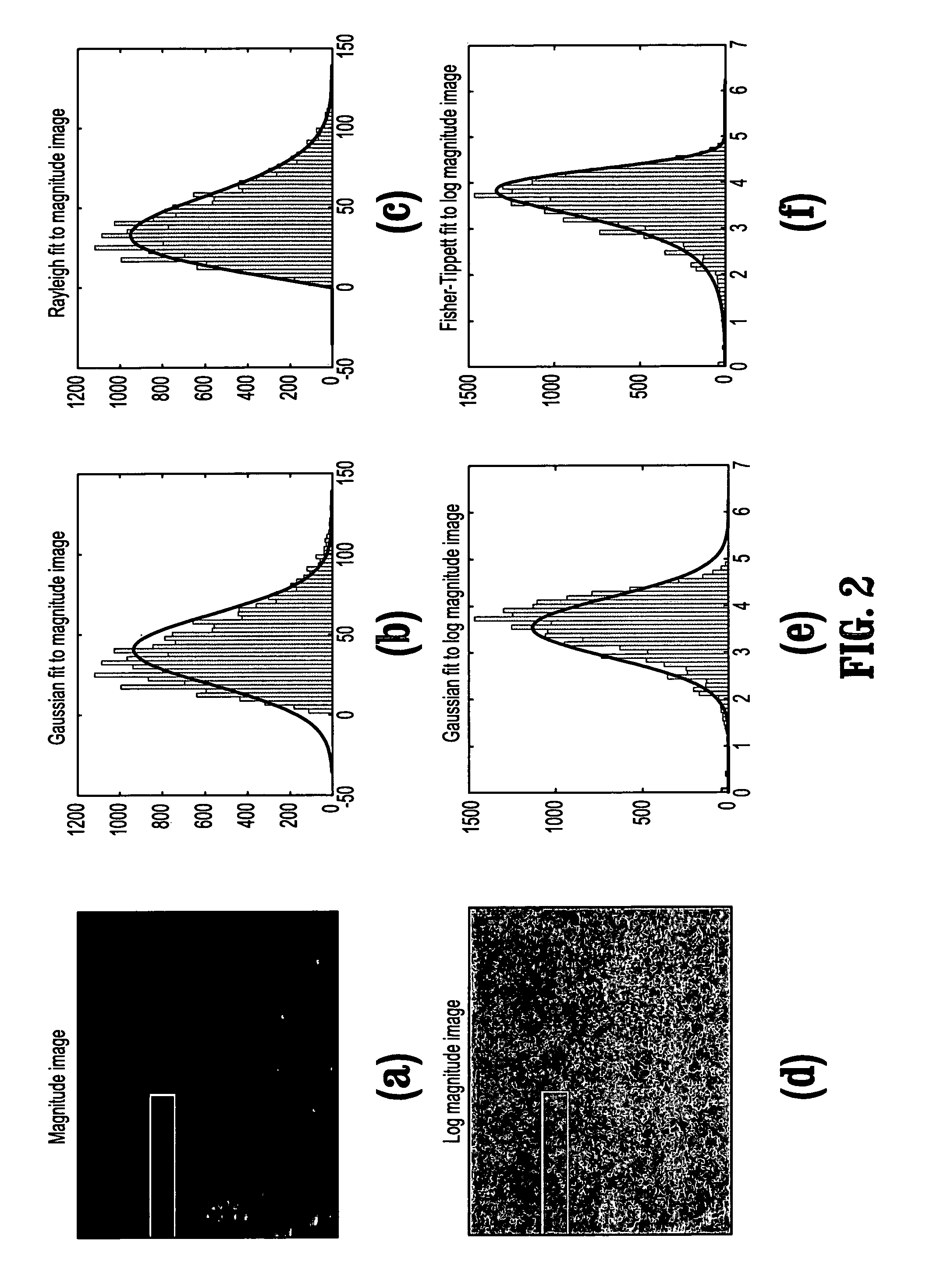 System and method for ultrasound specific segmentation using speckle distributions