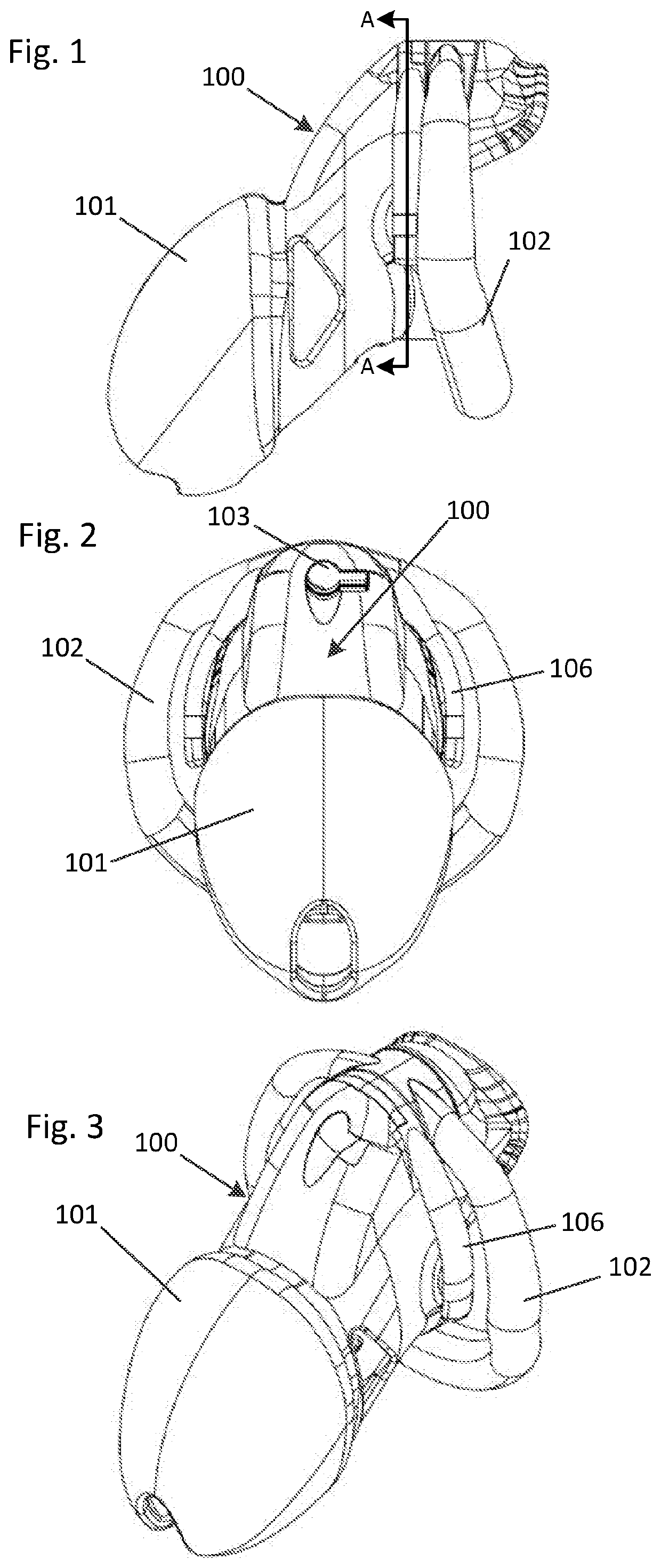 Resin-based male chastity device utilizing Anti-pullouts and multiple overmolded synthetic regions and coverings