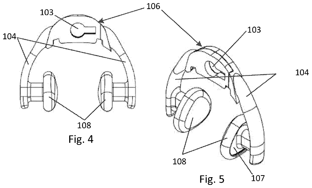 Resin-based male chastity device utilizing Anti-pullouts and multiple overmolded synthetic regions and coverings