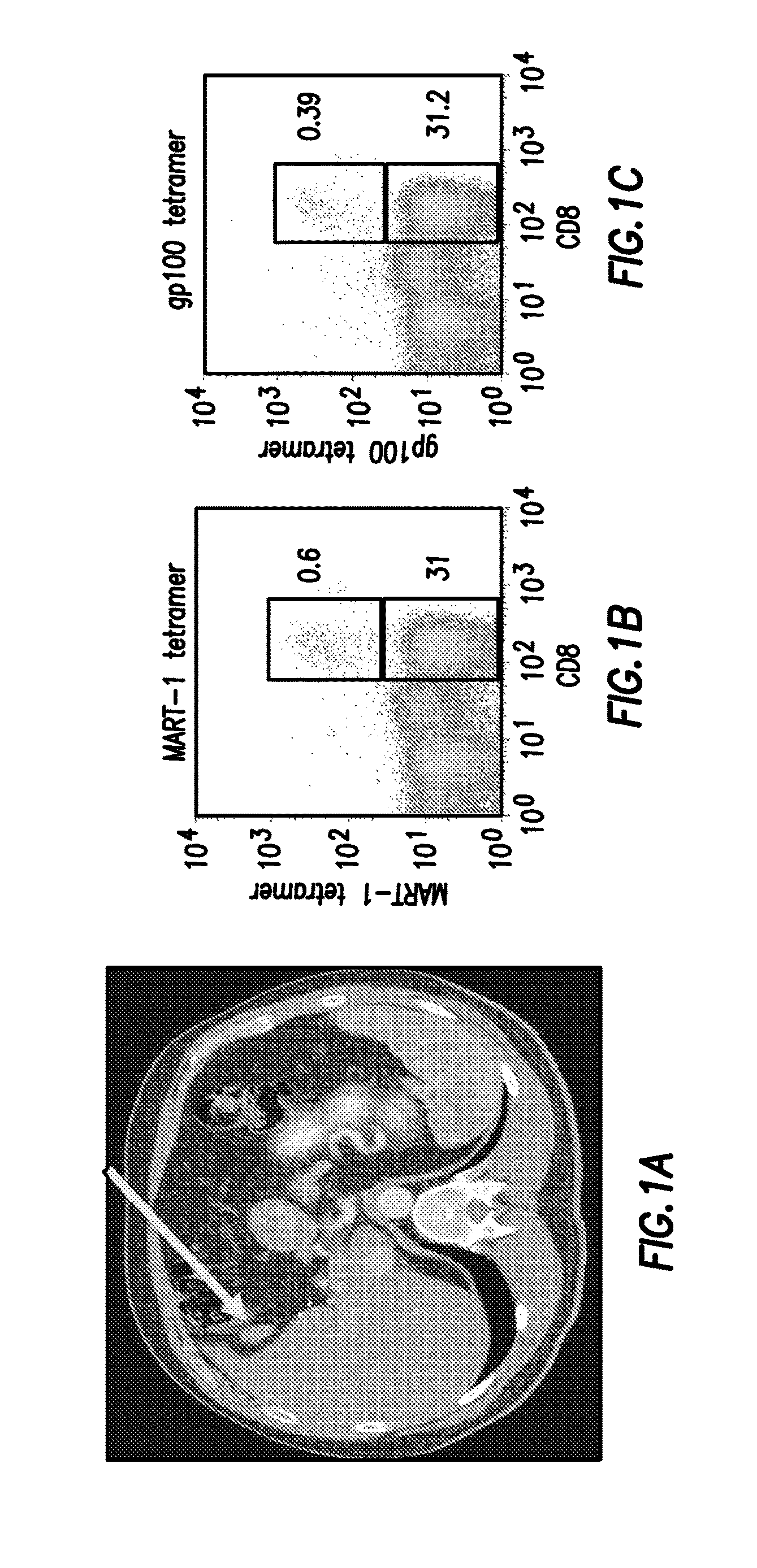 B and T lymphocyte attenuator marker for use in adoptive T-cell therapy