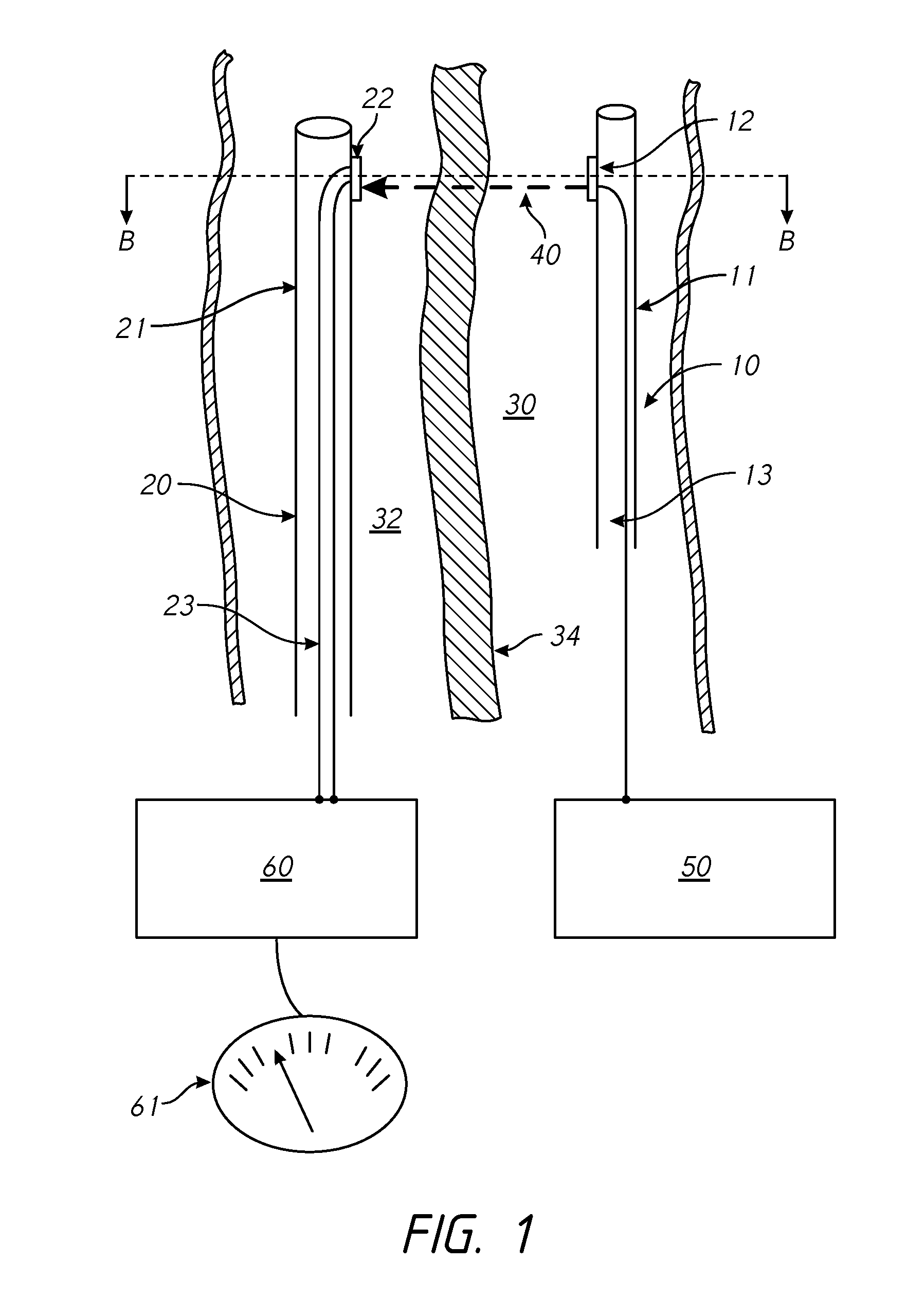Devices and methods for treating lower extremity vasculature