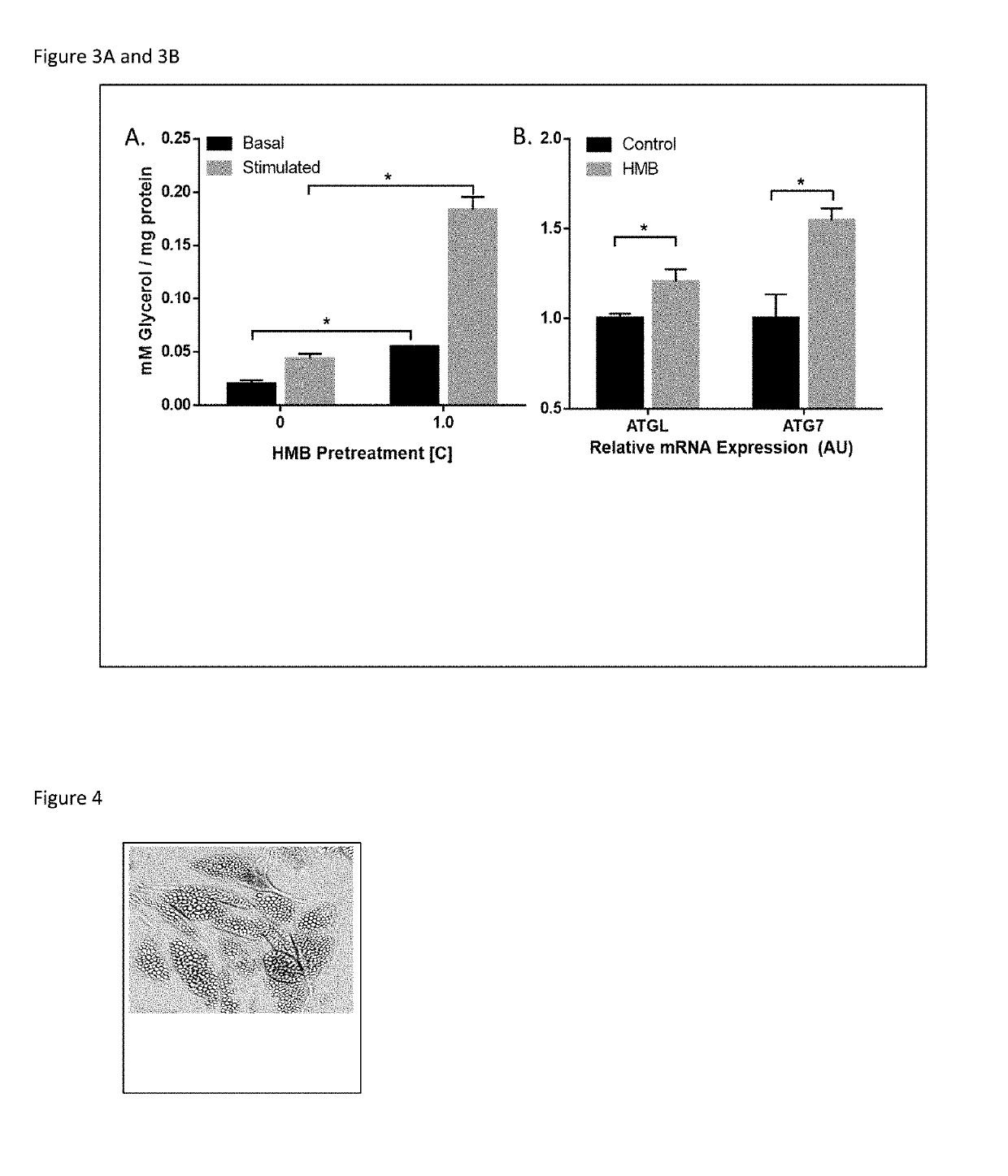 Compositions and Methods of Use of Beta-Hydroxy-Beta-Methylbutyrate (HMB) FOR MODULATING AUTOPHAGY AND LIPOPHAGY