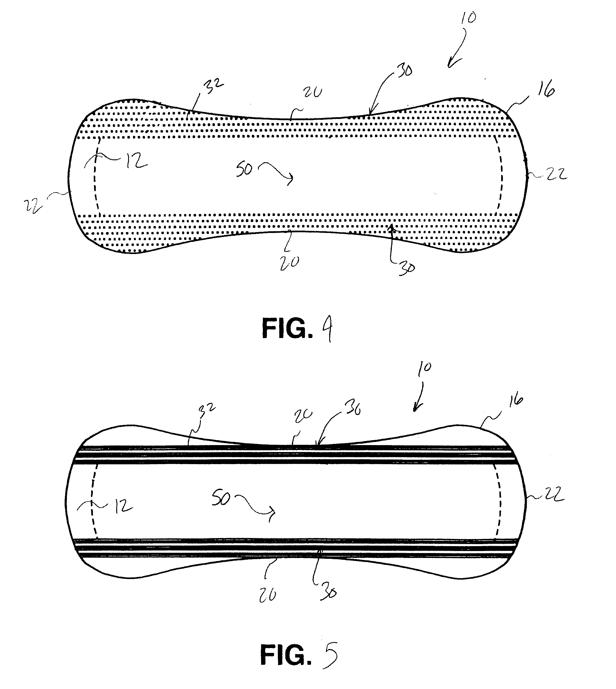 Zoned application of decolorizing composition for use in absorbent articles