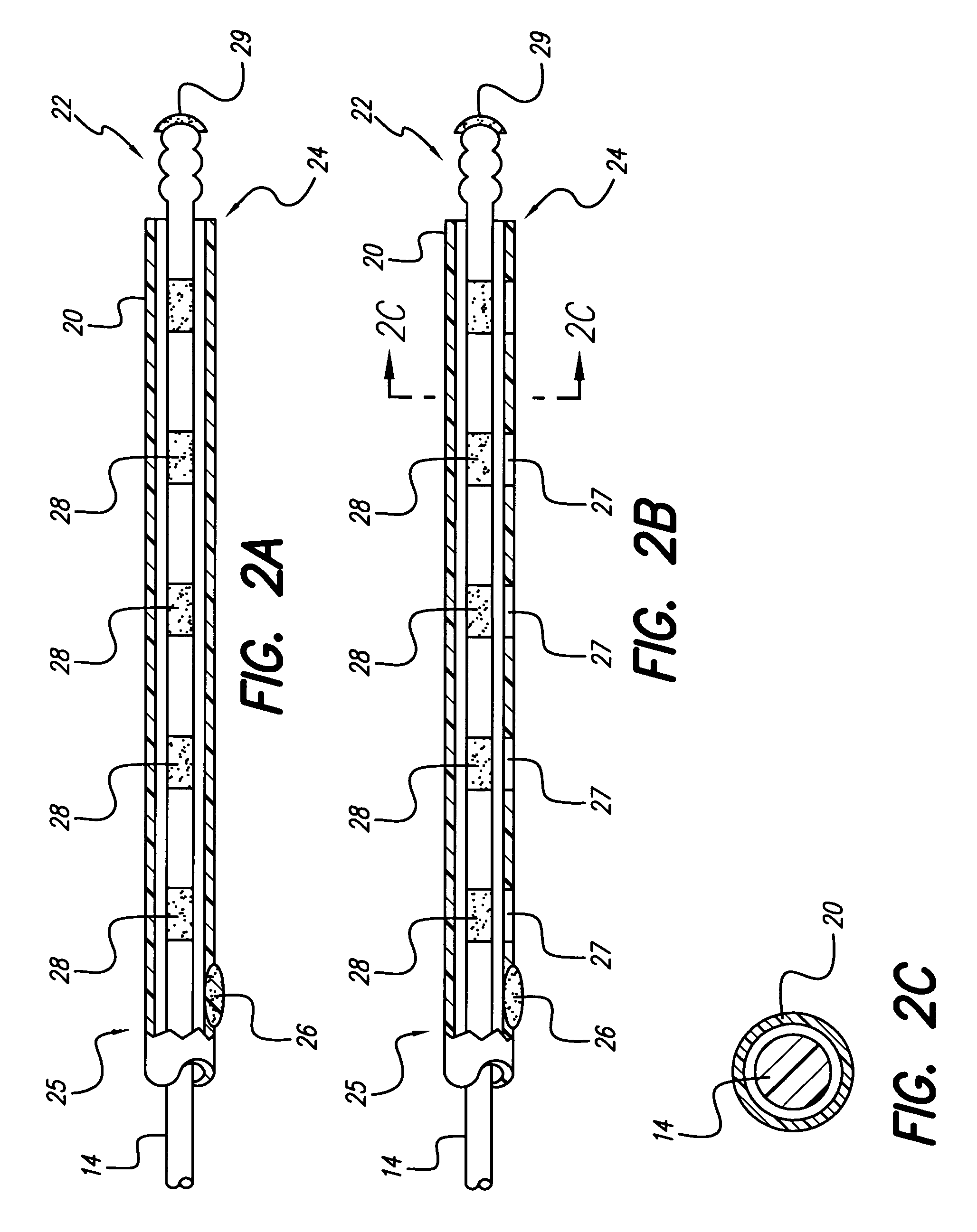 System and method for lead fixation