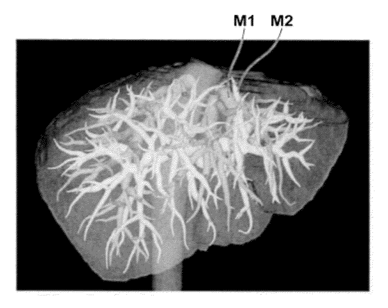 Tree structure creation apparatus, method and program