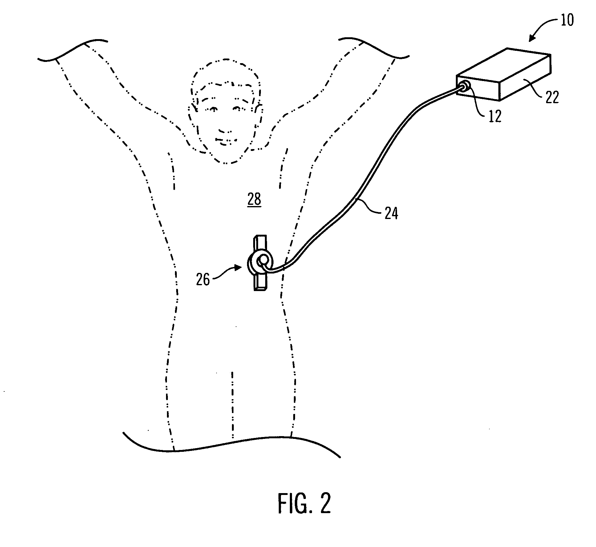 Control tabs for infusion devices and methods of using the same