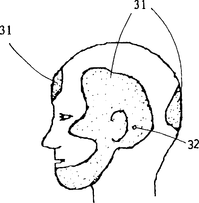 Telephone with receiver arousing bone-conduction and air-conduction hearing