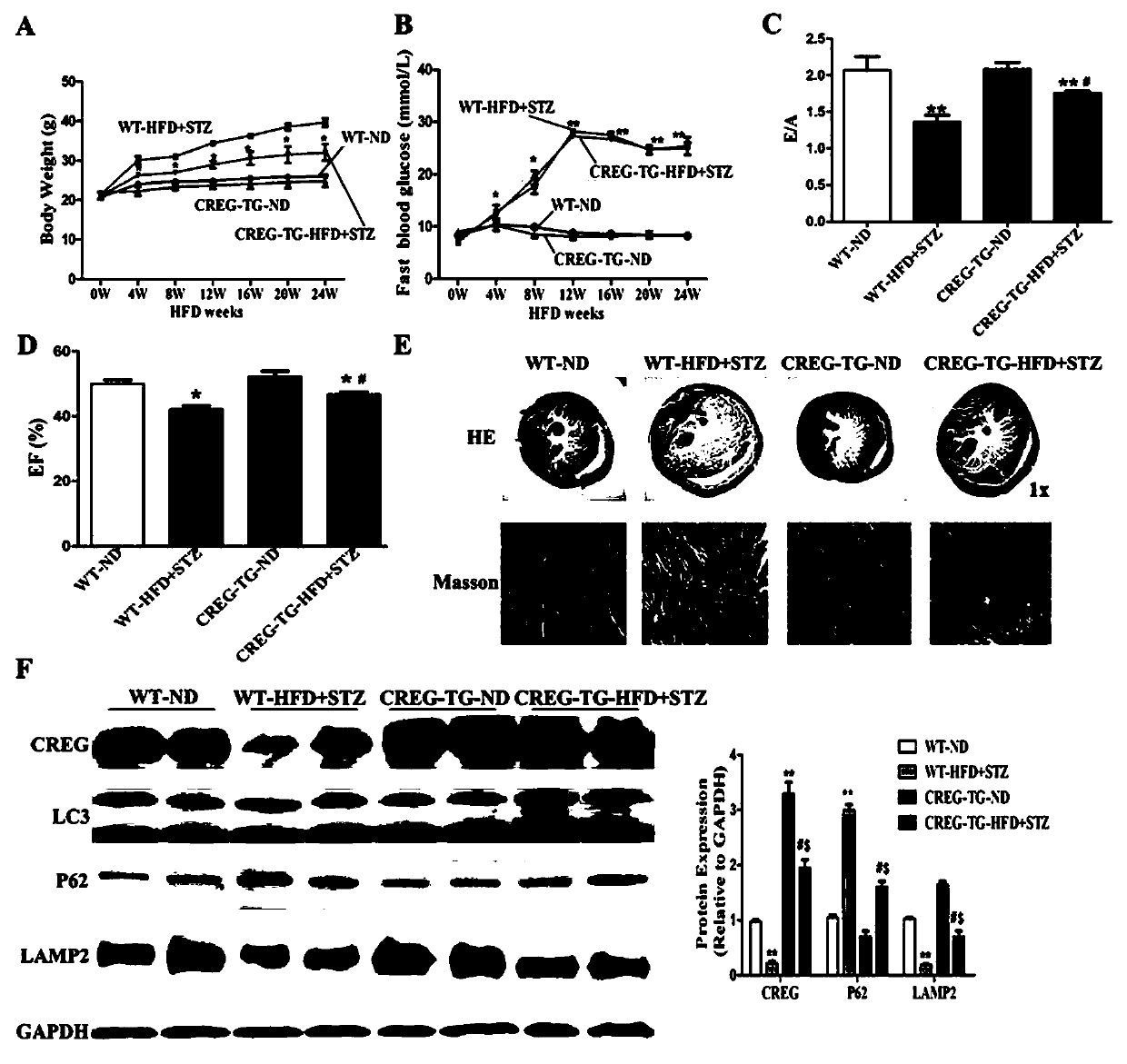 Medical application of CREG protein in prevention or treatment of diabetic cardiomyopathy