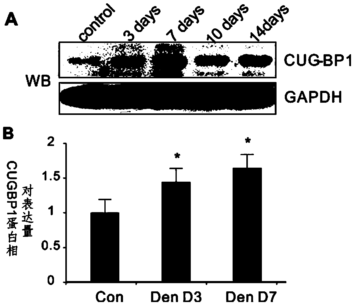 Application of CUG-BP1 (cytosine-uridineguanine-binding protein 1) and gene thereof in preparation of products for controlling and treating muscle atrophy diseases