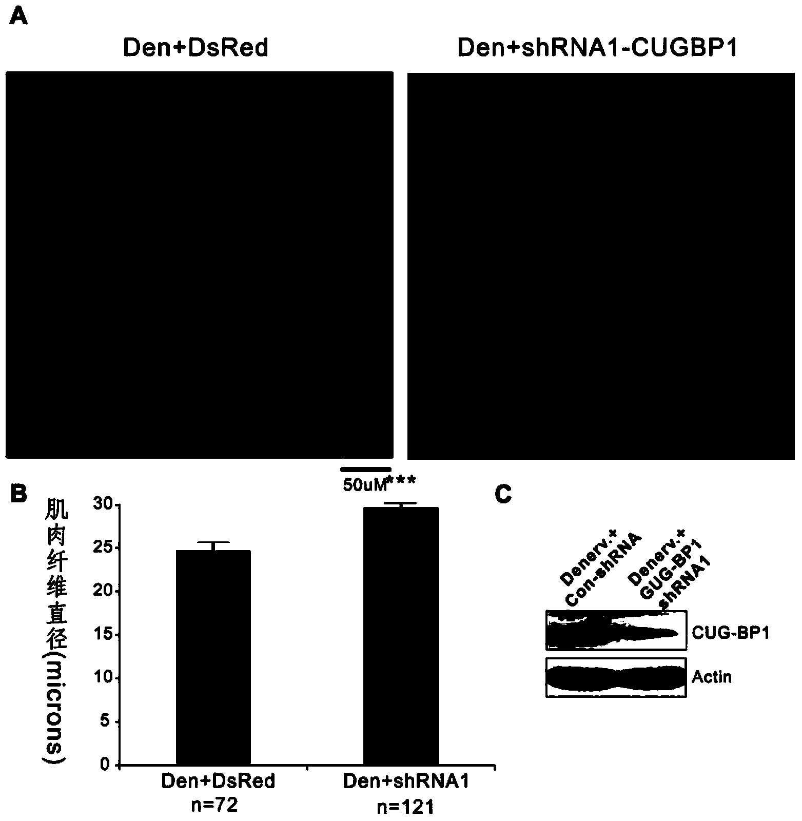 Application of CUG-BP1 (cytosine-uridineguanine-binding protein 1) and gene thereof in preparation of products for controlling and treating muscle atrophy diseases