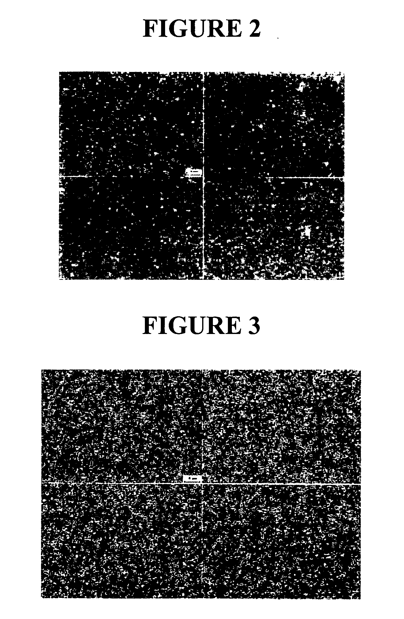 Injectable compositions of nanoparticulate immunosuppressive compounds