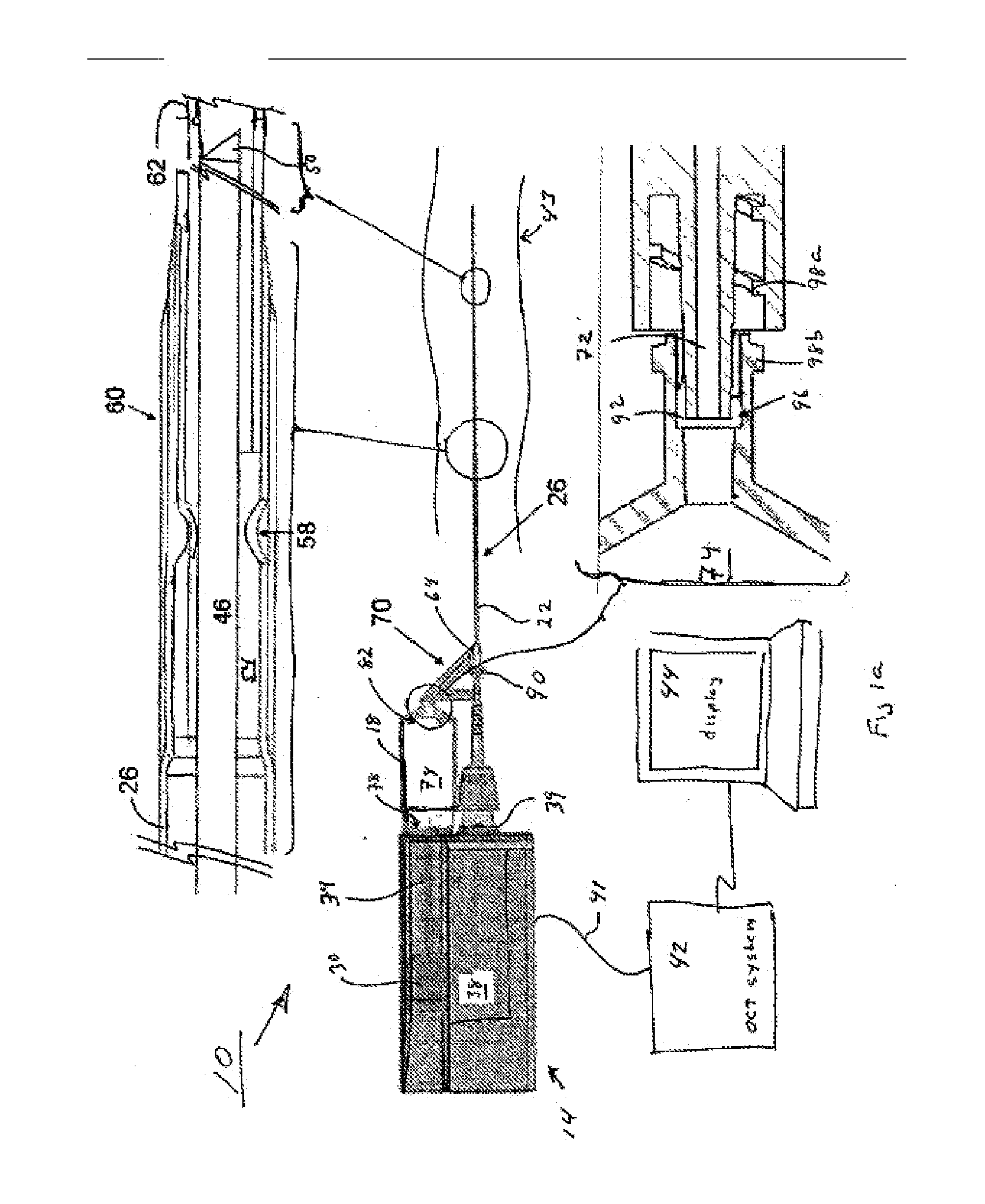 Automated Fluid Delivery Catheter and System