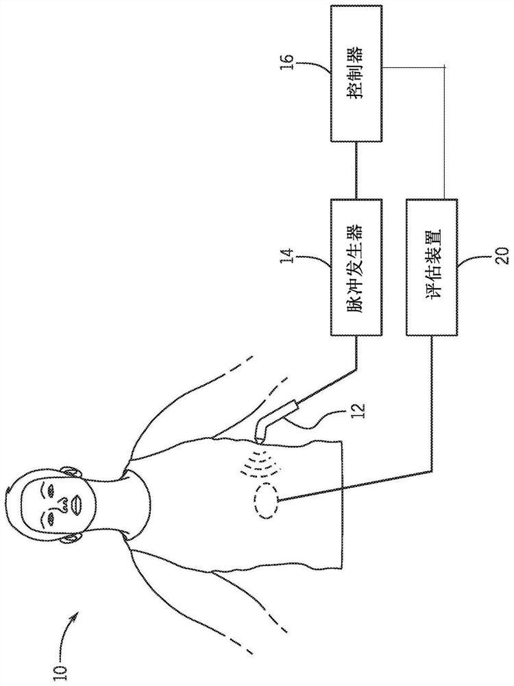 Ultrasound neuromodulation techniques