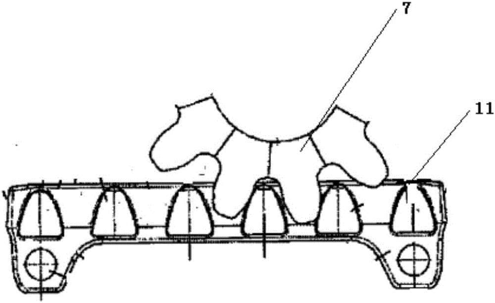 Scalp clip output apparatus