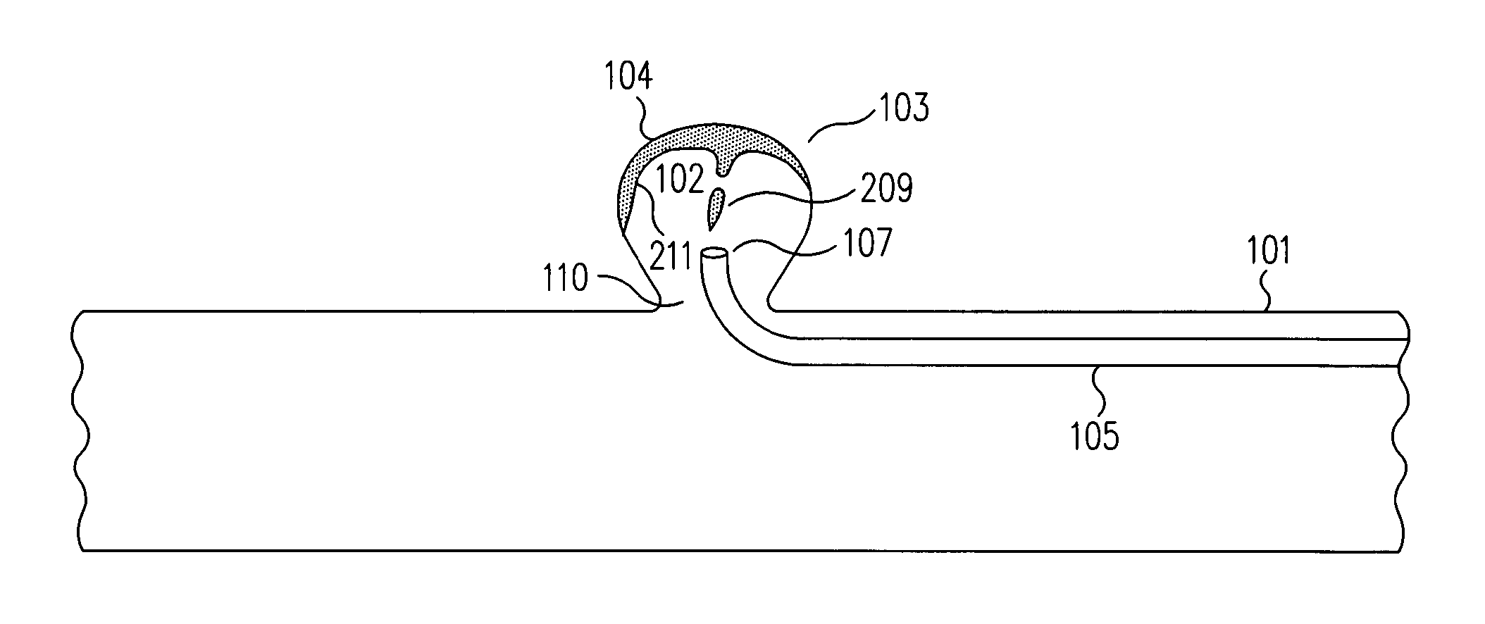 Method and apparatus for aneurismal treatment