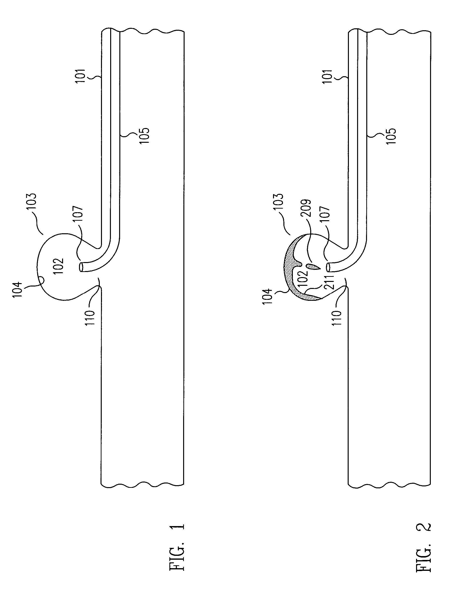 Method and apparatus for aneurismal treatment