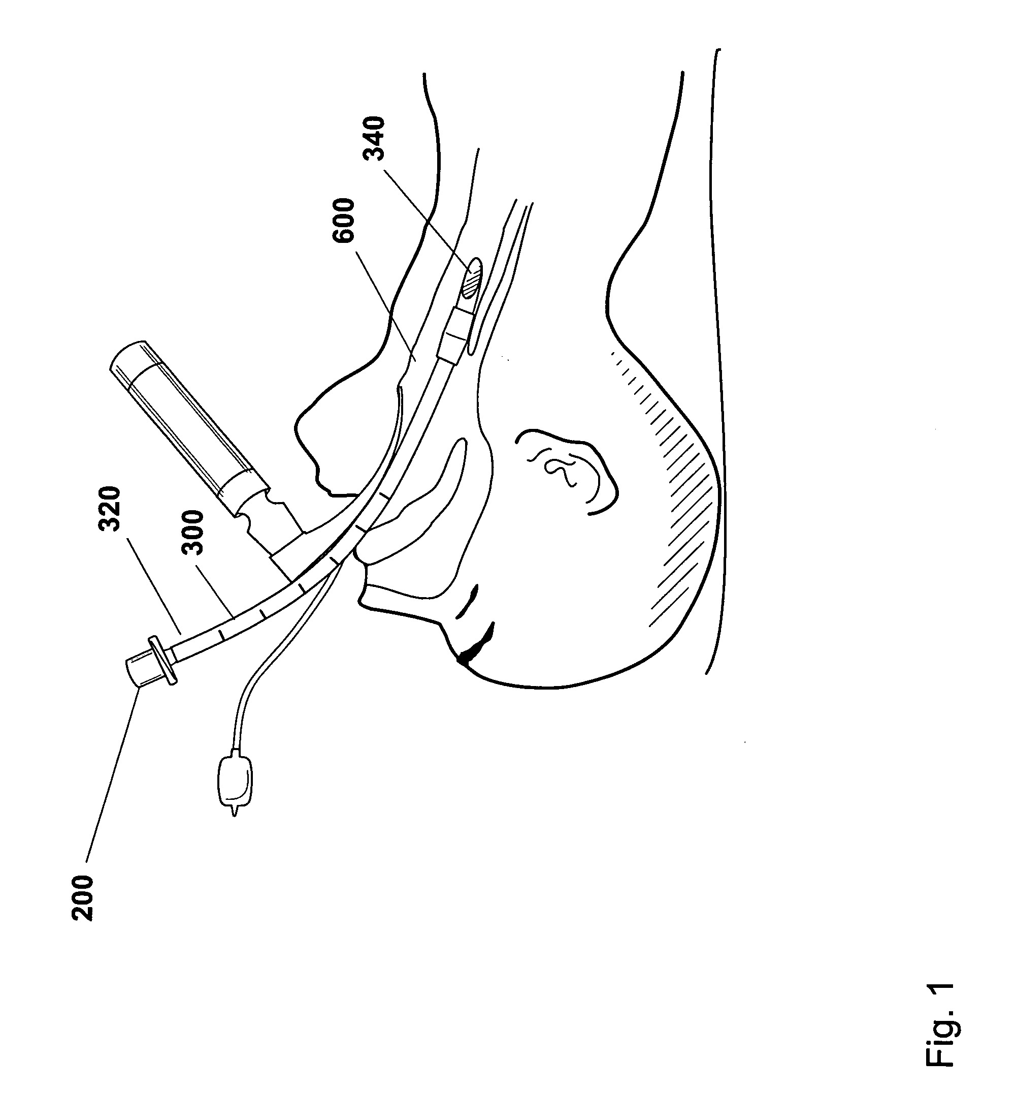 Endotracheal tube connector positioning system and method
