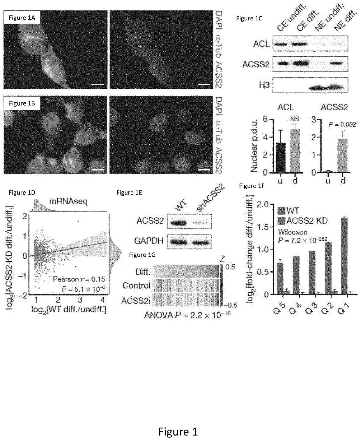 Compositions and methods for inhibiting acss2