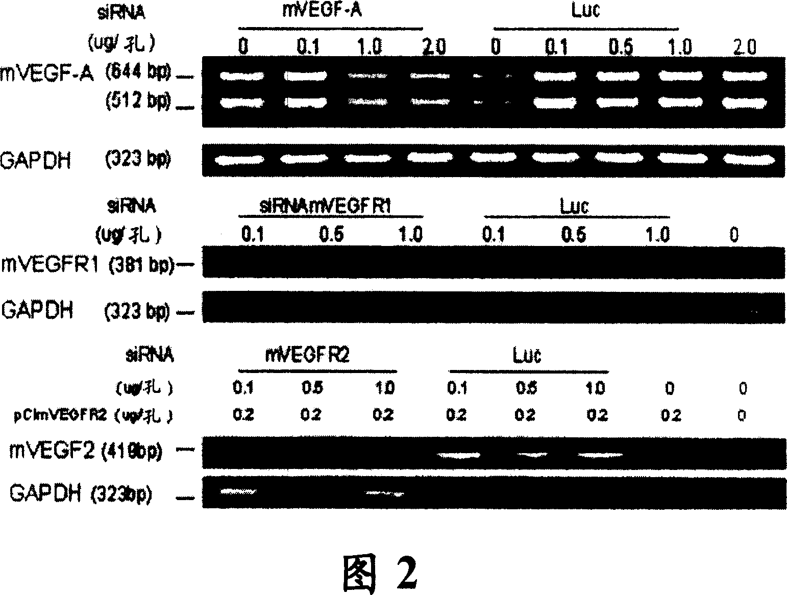 RNAi therapeutics for treatment of eye neovascularization diseases