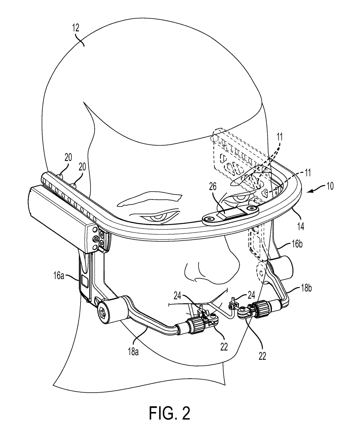 Craniofacial external distraction apparatus