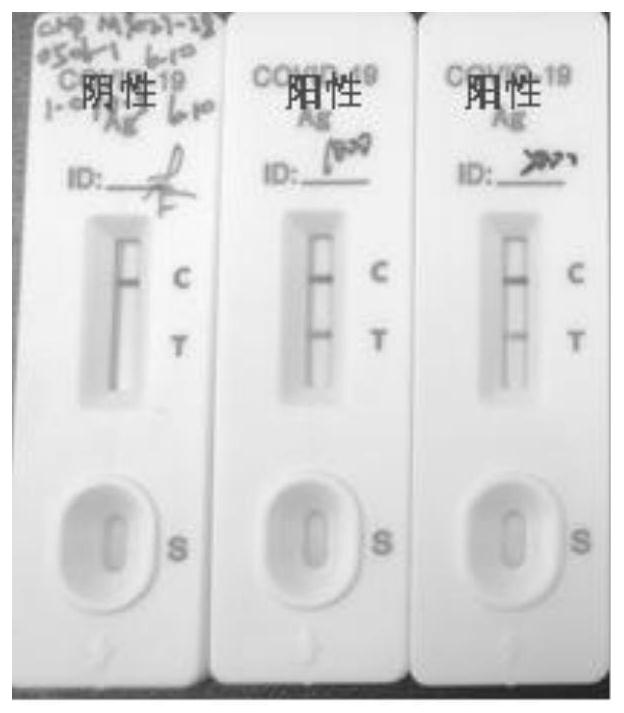 Novel coronavirus antigen detection kit and preparation method thereof