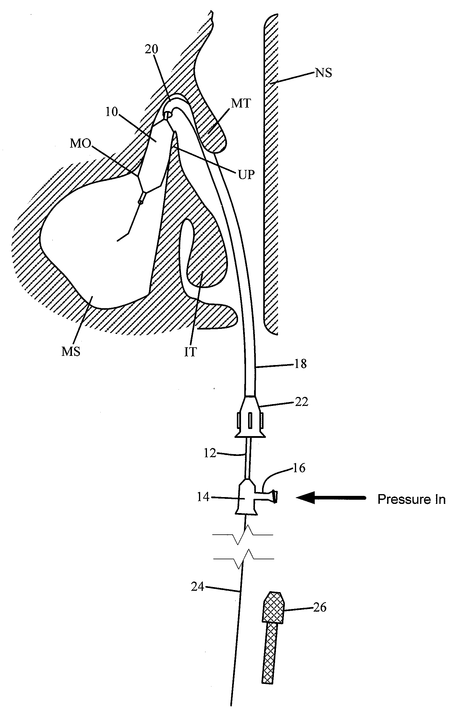 Method for accessing a sinus cavity and related anatomical features