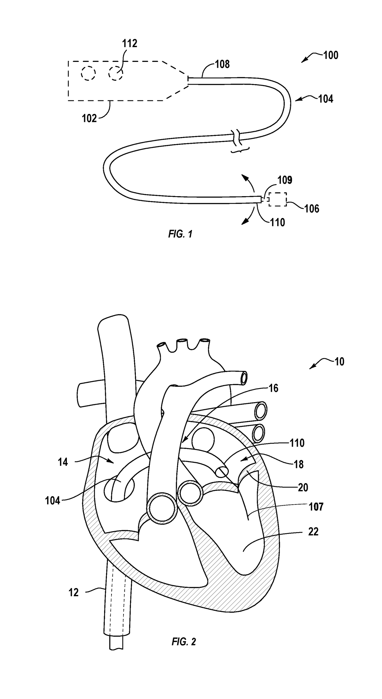 Tissue compression device for cardiac valve repair