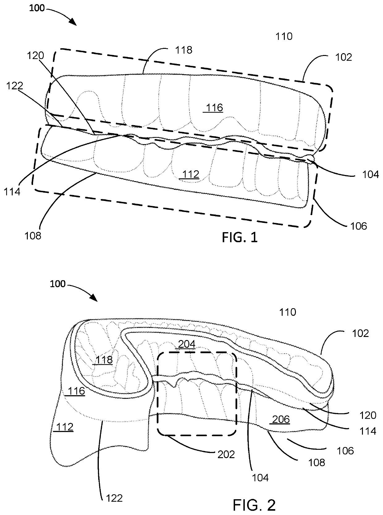 Oral appliance apparatus and method of operation thereof