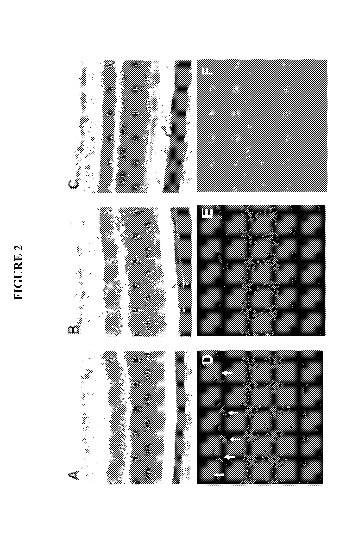 Methods and compositions for treating ophthalmic conditions