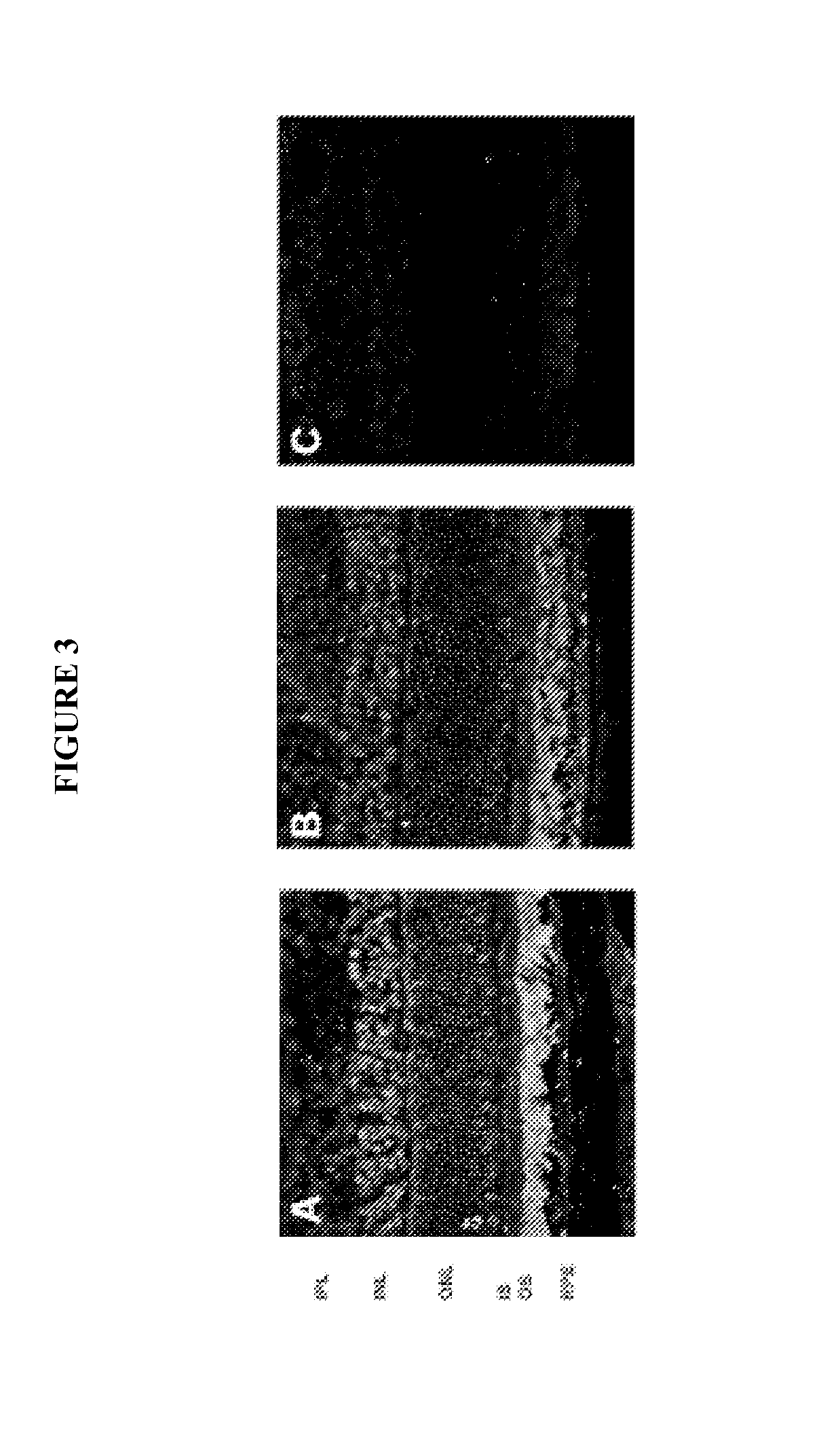 Methods and compositions for treating ophthalmic conditions