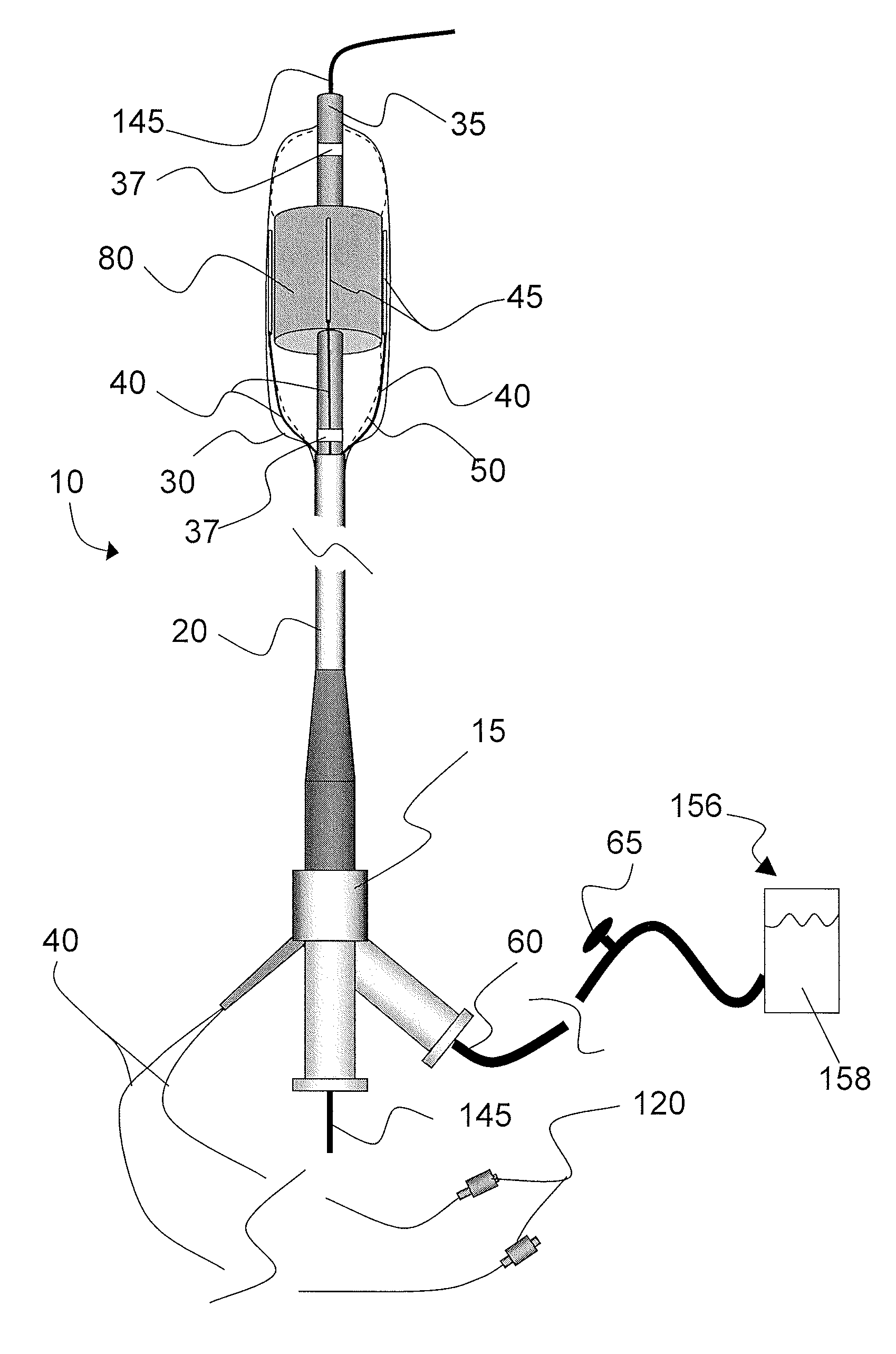 Systems and methods for analysis and treatment of a body lumen