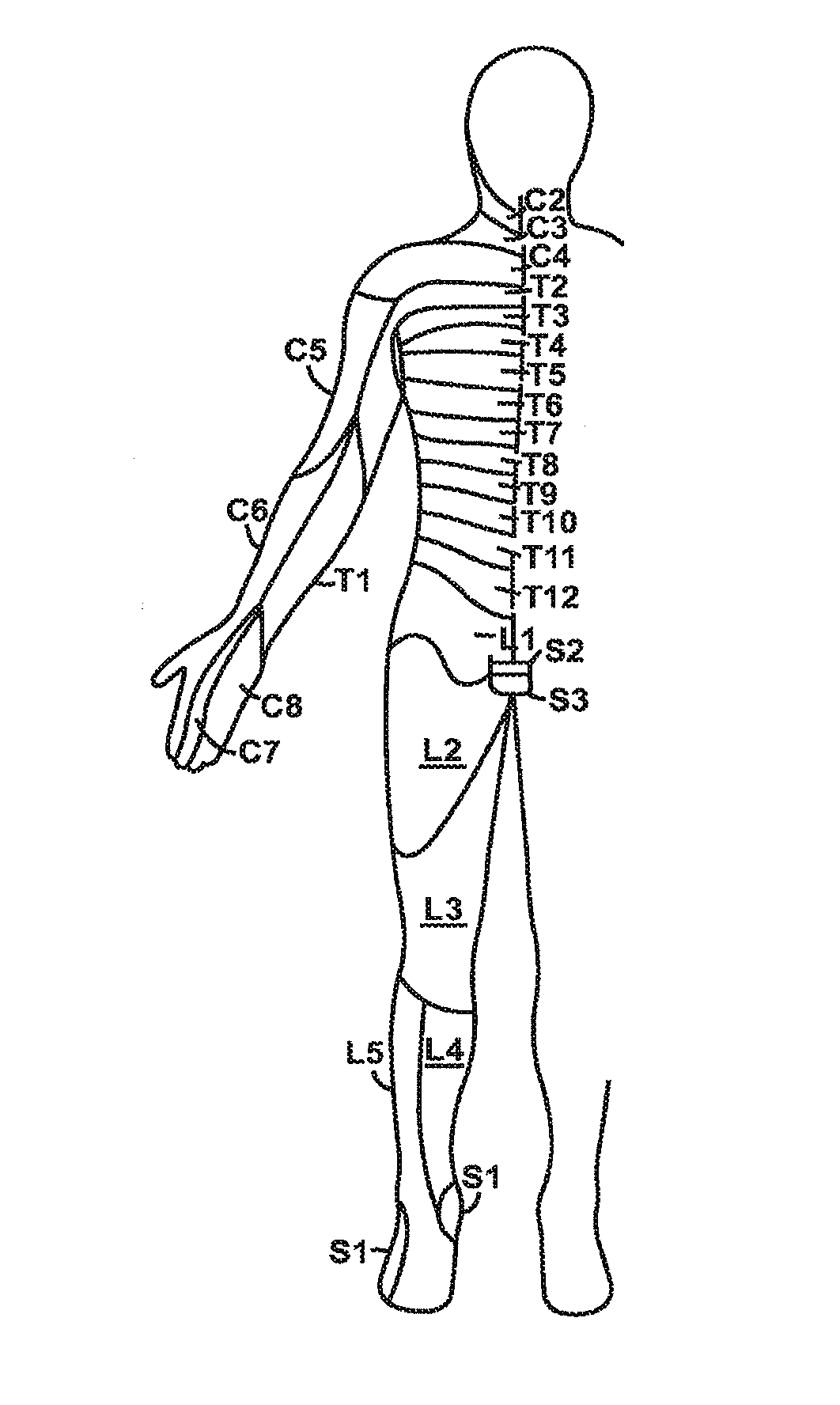 Systems and methods for neuromodulation for treatment of pain and other disorders associated with nerve conduction