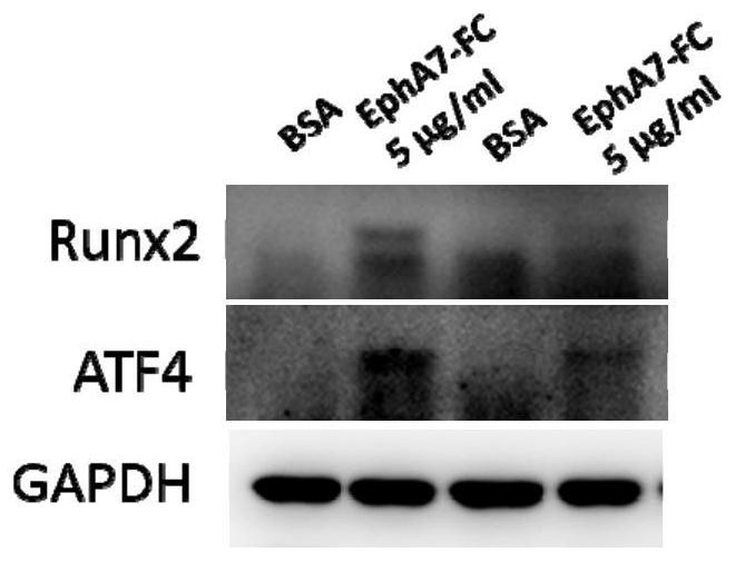 EphA7-Fc fusion protein and application thereof in drugs for preventing and/or treating osteoporosis diseases