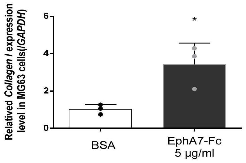 EphA7-Fc fusion protein and application thereof in drugs for preventing and/or treating osteoporosis diseases