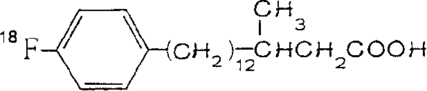 Aliphatic acid metabolic imaging agent beta-methyl-15-parafluoro [18F] phenyl-pentadecanoic acid and synthesizing method thereof