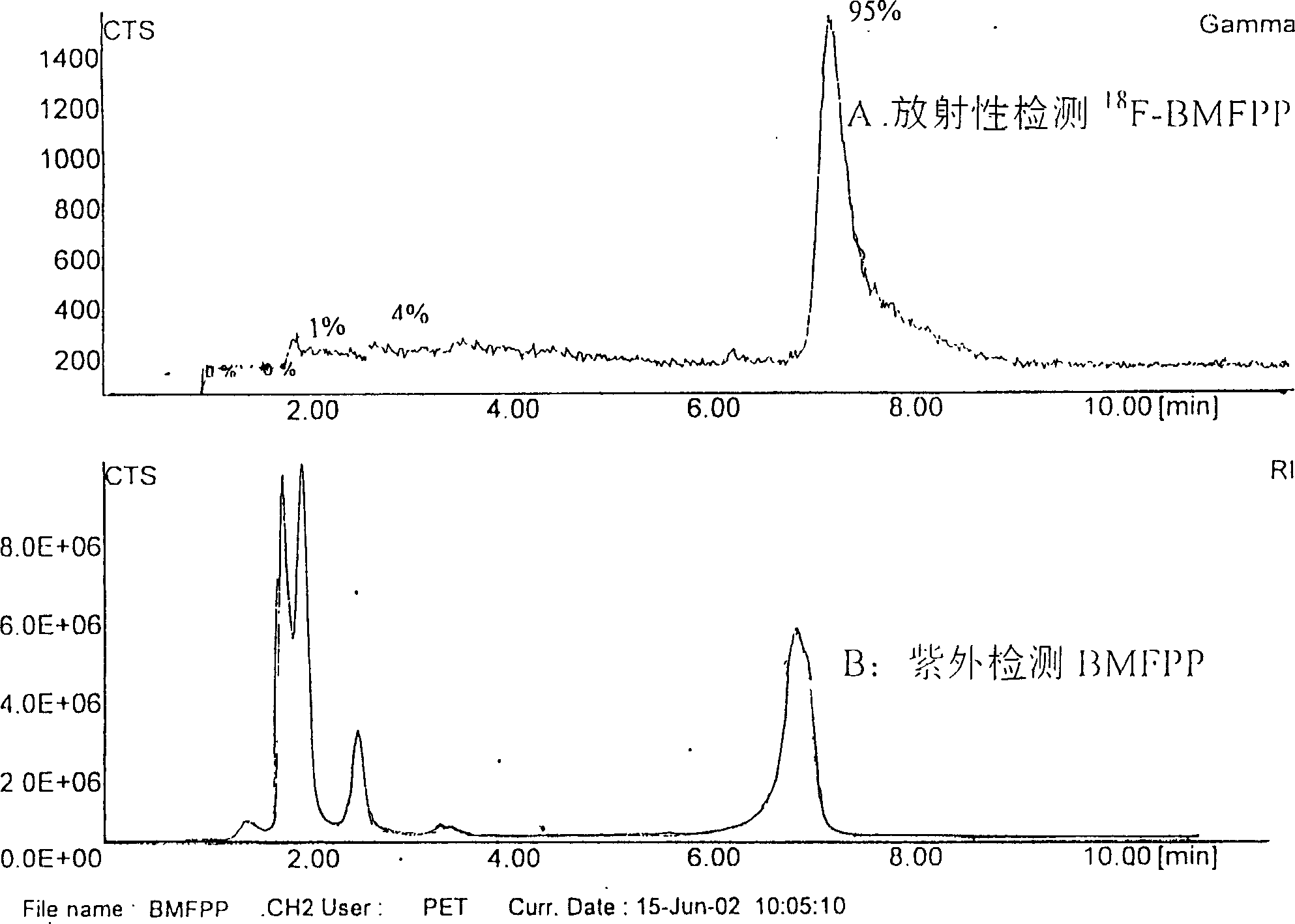 Aliphatic acid metabolic imaging agent beta-methyl-15-parafluoro [18F] phenyl-pentadecanoic acid and synthesizing method thereof