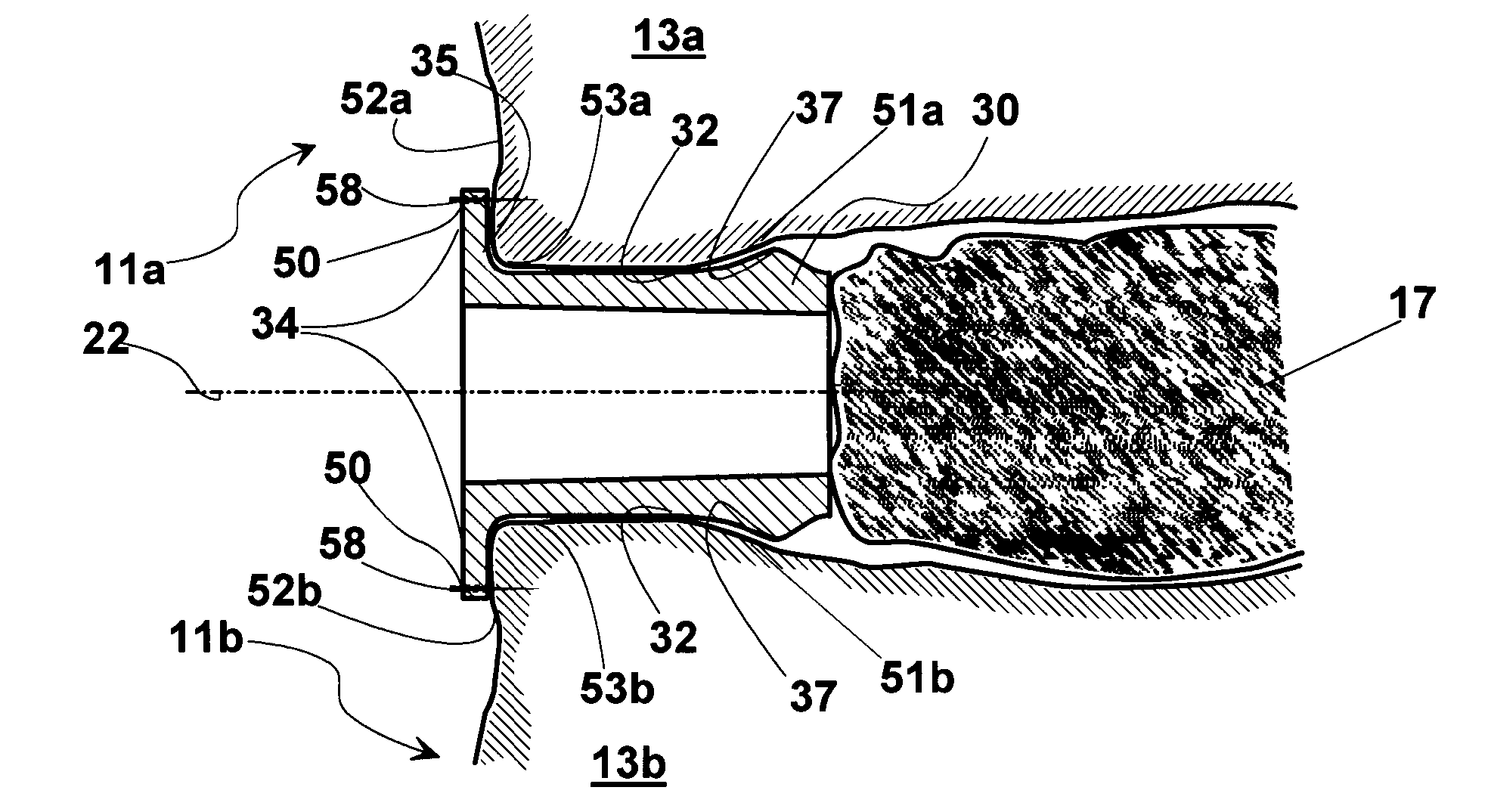 Intervertebral support